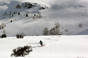 Brèche Esmarralhada